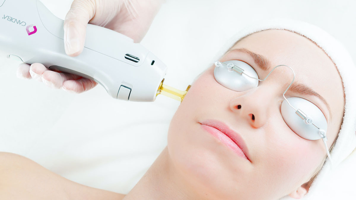 Laser Hair Removal