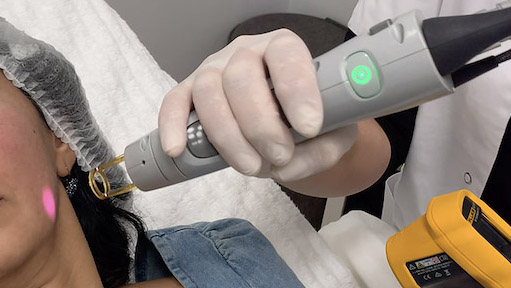 Skin Rejuvenation