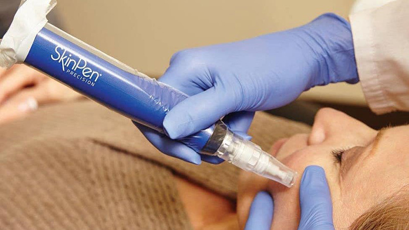 Microneedling - SkinPen