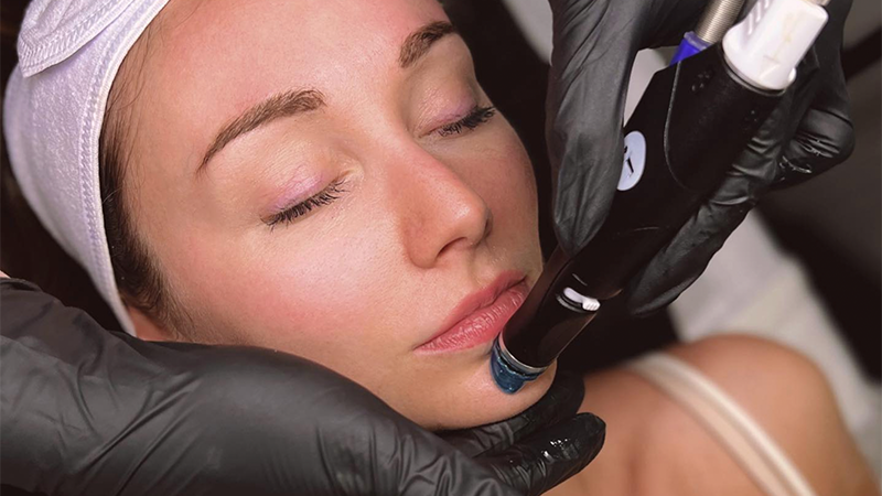 Hydrafacial