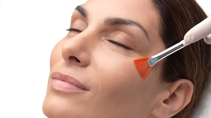 Mesopeel by Mesoestetic